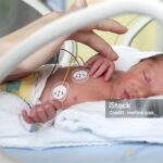 Kisah Mengharukan Bayi Prematur Pertama Dirawat di Inkubator, Berat Badan Hanya 1,3 Kg, Menjadi Harapan Baru bagi Neonatologi Indonesia